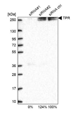 TPR Antibody, Novus Biologicals:Antibodies:Primary Antibodies